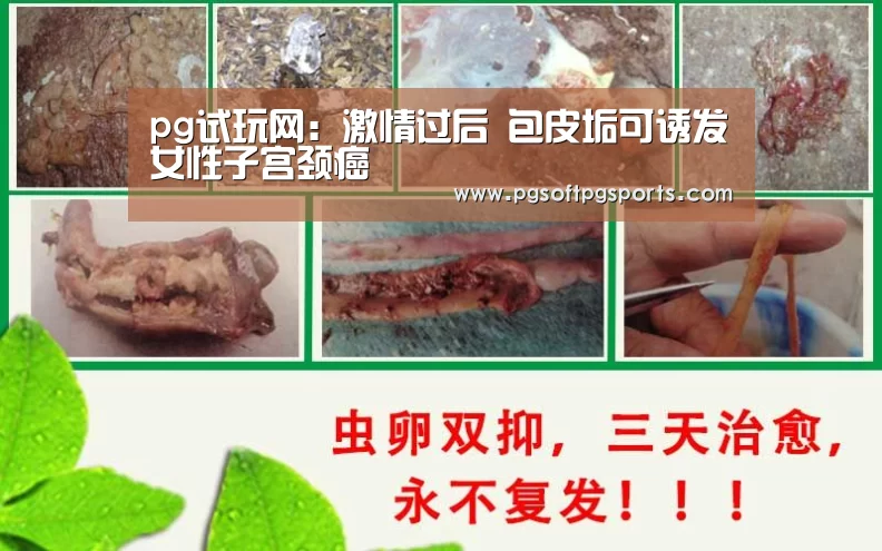pg试玩网:激情过后 包皮垢可诱发女性子宫颈癌(图2) pg电子麻将胡了官网